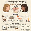 📖[논문] A Study on the Color of Hair and Melanin through Chocolate 🍫. 여성 연예인 모발이식 헤어라인