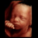 이마트24 강릉임당점 | [임신일기17] 24주차 정밀 초음파 | 임당 검사 | 입체초음파 실패 후 성공