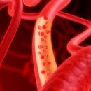 ﻿콜레스테롤 관리에 탁월… ‘올리브오일’이 몸에 좋은 5가지 이유 이미지