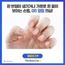 ■02월12일 수요일■어느 날 손톱에 생긴 검은 줄, 암 초기증상 일까요? 이미지