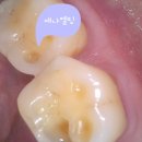 이윤치과의원 네이버블로그