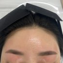영헤어라인 | 부천헤어라인왁싱 끌리영뷰티 헤어라인왁싱 받은 후기