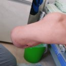 바른의수족제작연구소 이미지