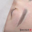 블레스브로우
