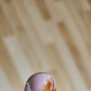 퍼스트 골든 | 포항 메디센터 더퍼스트의원 포항본점 피부과 진료후기