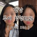 서울준신경외과의원 | [강남 성형외과] 무이성형외과 | 사각턱 보톡스 맞고 갸름이 되기 내돈내산 | 후기 효과 통증 주의사항