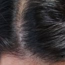 투쓰리 헤어라인 네이버블로그