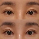 마이지나 | [더현대 입점 아이백다크서클패치 마이지 MYGE] 눈가 고민 해결 올클패치 사용 후기 👀✨