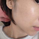 [첨단피부관리실] 월계동 본스킨 피부재생&피부활력 오투덤산소테라피 솔직후기!! (주차/가격)