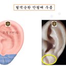 이혈(귀) 상담과 건강관리 | [부강주민 건강증진 프로그램]이혈테라피교육2회차:얼굴영역(눈,귀,치아 등)