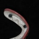 위드치과기공소 이미지