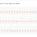 재발후 첫번째 외래 진료 이미지