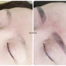 초지헤어라인