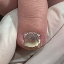 푸스케어 부산당감점 쿤스트뷰티 이미지