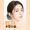 스펀지성형외과의원 | 석회화되면 코 재수술 할 수 있을까? | 강남구축코재수술