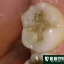 범플란트치과의원