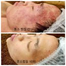 금화효소원 네이버블로그