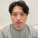 젠틀맥스프로플러스 강남역 피부과 콧수염 제모 [1회차]