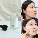 예뻐지기 - 달서구 당산로41길 102 | 얼굴 여드름 트러블 진정 케어 앰플 추천, 피부 예뻐지기 후기