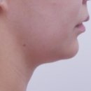 청담청초성형외과의원 이미지