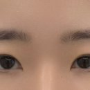 어닝브로우