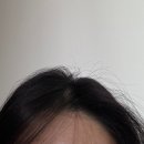 코리아병원 | 병원샴푸 볼빅 미토코리아 탈모샴푸 솔직 후기