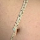 카리스 | 순천피부관리 / 복부관리 후기 [카리스 에스테틱]