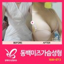 투모션 | 가슴성형후기 자신감 업!