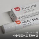 지우화장품 | 여드름 수술 켈로이드 흉터 연고 이야 흉터지우겔 사용 후기