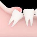 문정치과의원 이미지