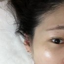 뷰티라운지J | 대구 칠성동 경락의 찐맛집|뽑&채움by_J뷰티라운지 후기