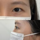 라본느 | 옥길동 속눈썹펌 라본느 속쌍커풀 비포 애프터 후기