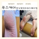 반자주 W스퀘어점 | 푸스케어 부산광안W스퀘어점 | 발각질제거 발각질케어 쩍쩍갈라지던 발뒷꿈치를 아기발로 만들고 온 후기