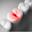 섬세한사랑니치과의원 이미지