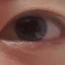 굿아이금천이안과의원 | 굿아이금천이안과 - 따뜻한 명의가 전문적으로 진료해주는 병원