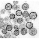 [해외질병주의] 신종 코로나바이러스 : 사우디아라비아,프랑스 발생 * 사람간에도 전염/해당지역 여행/무역 제한 및 백신주사접종 이미지