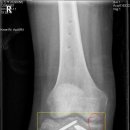 야이노마 이미지