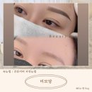 미모당 | [경산 사동눈썹 / 경산 눈썹문신 잔흔커버 솔직후기] 미모당