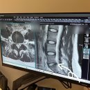 바로정형외과의원 | 동탄 감탄정형외과의원 MRI 후기 :: 허리디스크 판정, 실비 지급
