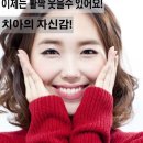 e스마일치과기공소 | 창원치과의 충치치료로 스마일 미인되기