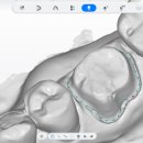 영치과기공소 이미지