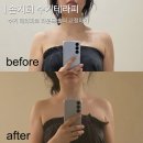 라온어린이집 | 부천경락 신중동역마사지 손지희수기테라피에서 라운드숄더 관리 받은 후기