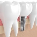 탑플랜치과의원 이미지