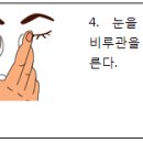 녹내장 치료제 이미지