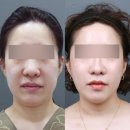 미니거상 유지기간, 왜 1~2년에 그칠까? 원리로 설명드립니다.