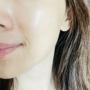 오투에스 | 광교피부관리 스킨앤미 오투덤 산소테라피 후기