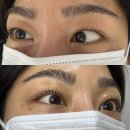 올케어성형외과의원 | 속눈썹펌 추천｜사가정 속눈썹펌, 면목동 속눈썹펌 ‘블리로움 뷰티크 사가정 본점’ 눈매성형펌 후기