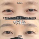 고산자로34길 | [서울 동대문] 자연스러운 눈썹 '미채움스튜디오' 재방문 후기