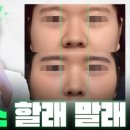 오브제성형외과의원 | 콧볼축소수술 후기 사람에 따라 갈리는 이유? 바로 ‘이것’입니다 <박시현 원장님 핵심 포인트>