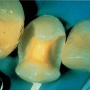 모양치과기공소 이미지